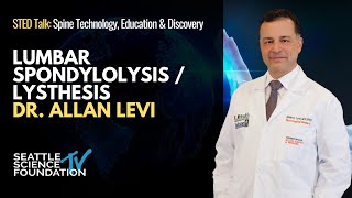 Lumbar Spondylolysis  Lysthesis  Allan Levi MD [upl. by La Verne]