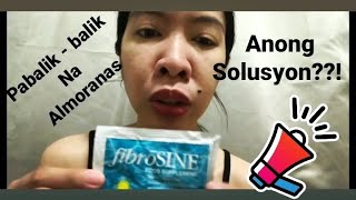 almoranas hemorrhoids mga dapat gawin pra gumaling [upl. by Prestige455]