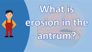 What is erosion in the antrum   Best and Top Health FAQs [upl. by Husha]