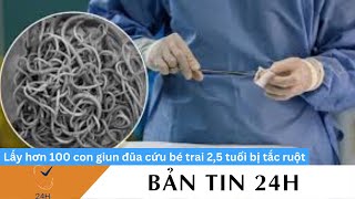 Lấy hơn 100 con giun đũa cứu bé trai 25 tuổi bị tắc ruột [upl. by Ahsieym]