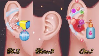 Asmr Ear Wax Removal🔥Asmr Ear wax CleaningAsmr Ear WaxEzafi asmr [upl. by Marlea]