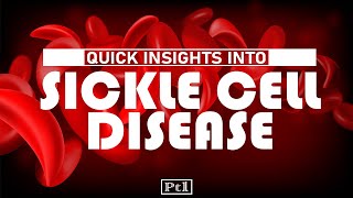 Quick Insights Into Sickle Cell Disease Pt01 [upl. by Oyek65]