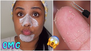 DIY Pore Strips Get Rid of BlackheadsWhiteheads  EASY [upl. by Atinnek]