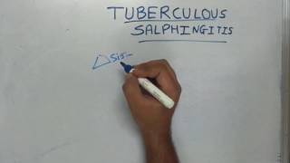 Tuberculous Salphingitis [upl. by Aihseket]