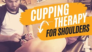 Cupping Therapy Techniques for the Shoulder [upl. by Dimitris87]