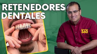 Retenedores Dentales ¿Qué son y por qué se usan [upl. by Odlo]