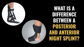 Night Splints  What is the difference between a posterior and anterior night splint [upl. by Antonio]