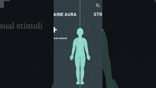 Migraine Aura or Stroke How to Tell the Difference [upl. by Zack]