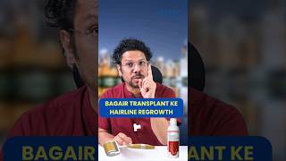 Bagair Transplant ke Hairline Regrowth Hair Loss  Hair tips  Receding Hairline adonhaircare [upl. by Mattox]