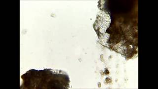 Demodex  killing in seconds with ethanol [upl. by Minnaminnie555]