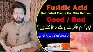 Fudic H Fusidic Acid Cream Uses  Side Effects  How to Use Fudic H Cream  Beauty Facts [upl. by Oirevas108]