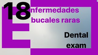 18 Enfermedades Bucales Raras Rifando Material De Estudio [upl. by Alakam]