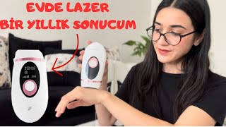 XIAOMI İNFACE İPL 1 YILLIK SONUCUM evdelazer [upl. by Zitella30]