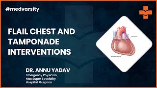 Flail Chest amp Tamponade Interventions  Medical Case Discussion [upl. by Eiliah]