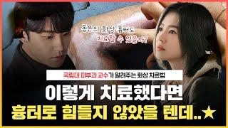 👩🏻‍⚕️화상amp화상 흉터는 이렇게 치료하는 겁니다｜심해 보이는 동은이의 화상이 2도라고｜단계별로 화상 설명해 줌  언니네피부과 [upl. by Soo]