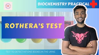 Rotheras Test URINE TEST FOR KETONE BODIES  BIOCHEMISTRY PRACTICAL with viva questions [upl. by Durgy]