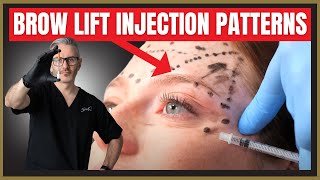 Botox Brow Lift Injection Patterns Botox MarkUp Tutorial [upl. by Aznofla655]