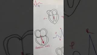 Basic ECG Part 1 bangla [upl. by Eeimaj]