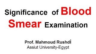 Significance of Blood Smear Examination Arabic Lecture 2017 [upl. by Zelle77]