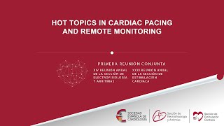 Hot topics in cardiac pacing [upl. by Bronwyn391]