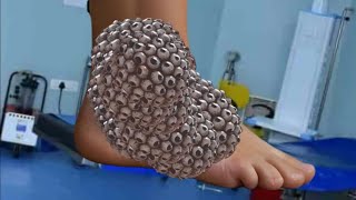 Asmr Deep Cleaning  Asmr Deep Cleaning  Asmr Foot Care Animation🤯😱SmallASMR9 [upl. by Bryana]