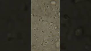 How sperm looks under a microscope shorts [upl. by Hamachi]