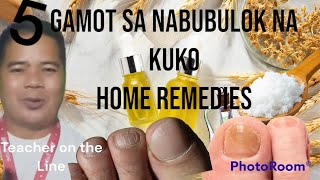 GAMOT SA NABUBULOK NA KUKO Home remedies [upl. by Dawkins]