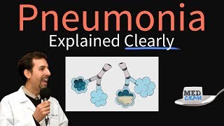 Pneumonia Explained Clearly by MedCramcom [upl. by Nicky]