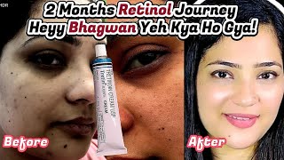 2Month RetinolTretinoin Journey My Results Challenges and Tips [upl. by Parke967]