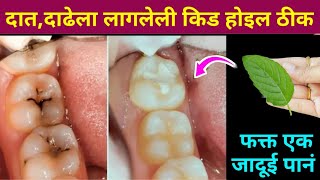 घरातील फक्त 2 वस्तू वापरा दातांन संबंधित सर्व समस्या दूर होतील😱 kitchen tips  teeth  home remedies [upl. by Eneladgam]