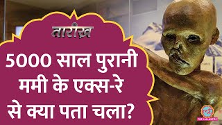 5000 साल पुरानी Mummy के एक्सरे से क्या पता चला  Otzi the Iceman  Tarikh E555 [upl. by Irrac301]