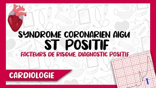 Syndrome Coronarien Aigu Segment ST Positif  Diagnostic Positif Symptomes amp ECG Complications [upl. by Navillus]