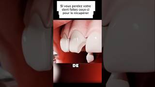 Processus de réparation dune dent shortvideo sciencepopulaire shorts dentist shortviral [upl. by Telimay]