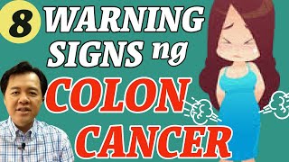 8 Warning Signs ng Colon Cancer  By Doc Willie Ong 1081 [upl. by Harim358]