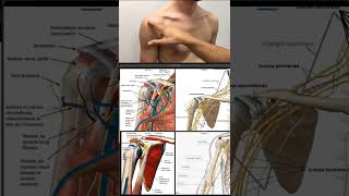 auscultation général de lépaule [upl. by Bascomb]