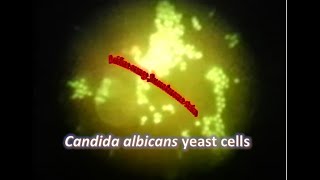 Candida albicans under Fluorescence microscope stained with Acridine Orange [upl. by Bobette97]