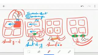 🔴 ASTUCE CARDIOPATHIES CONGENITALES   DR ASTUCE [upl. by Syd524]