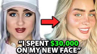 I was UGLY Before Spending 30000 on a NEW FACE  Surgeon Reacts [upl. by Ttesil687]