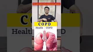 Best Exercise for COPDChronic obstructive pulmonary disease Relief shorts tranding [upl. by Conlen63]