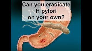 Can you eradicate H pylori on your own [upl. by Waldon545]