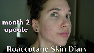 Roaccutane Daily Skin Diary  Month 2  The Purge Begins Low Dose [upl. by Yeruoc]