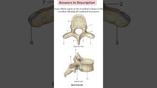 identify the parts of vertebrae humananatomy [upl. by Orly982]