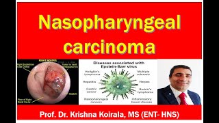 Nasopharyngeal Carcinoma  Medical students  Slide Explanation Dr Krishnas ENT Lectures [upl. by Dru]