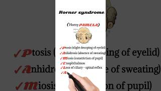 horner syndrome mnemonic [upl. by Attelahs]