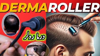 Microneedling  Derma Rolling for Hair Regrowth  Derma Roller Side Effects [upl. by Irianat]