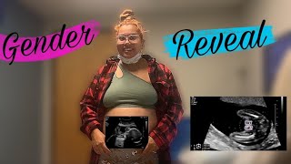 24 Weeks Pregnant Ultrasound amp GENDER REVEAL [upl. by Airec]