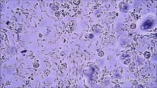 Sabin Feldman dye test Toxoplasmosis Part two Marwa Omar [upl. by Stillmann]