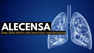 Alecensa Targeted Therapy for ALKPositive Lung Cancer [upl. by Vivica741]