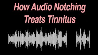 How Audio Notching Treats Tinnitus [upl. by Adnamal]