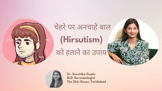 Hirsutism चेहरे पर अनचाहे बाल   Causes amp Treatment Dr Sanchika Gupta dermatologistinfaridabad [upl. by Cocke]